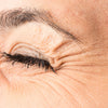 Crows Feet:
